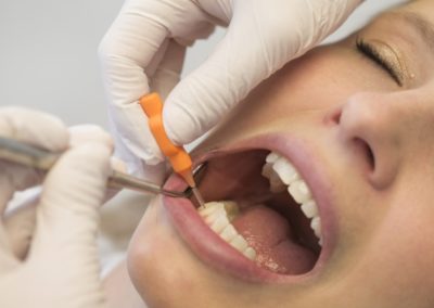 Munich Dent Zahnarztpraxis Zahnreinigung